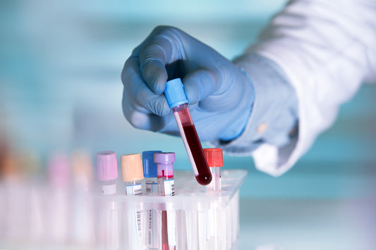 Blood Tests to Ask your Doctor For That You Aren’t Getting