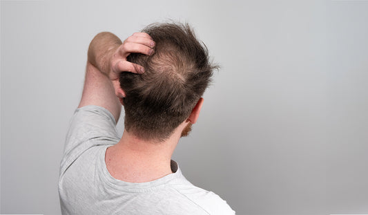 Hair Loss Mystery Solved: The Surprising Causes You Didn’t Expect