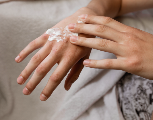 7 Strategies to Eliminate Eczema